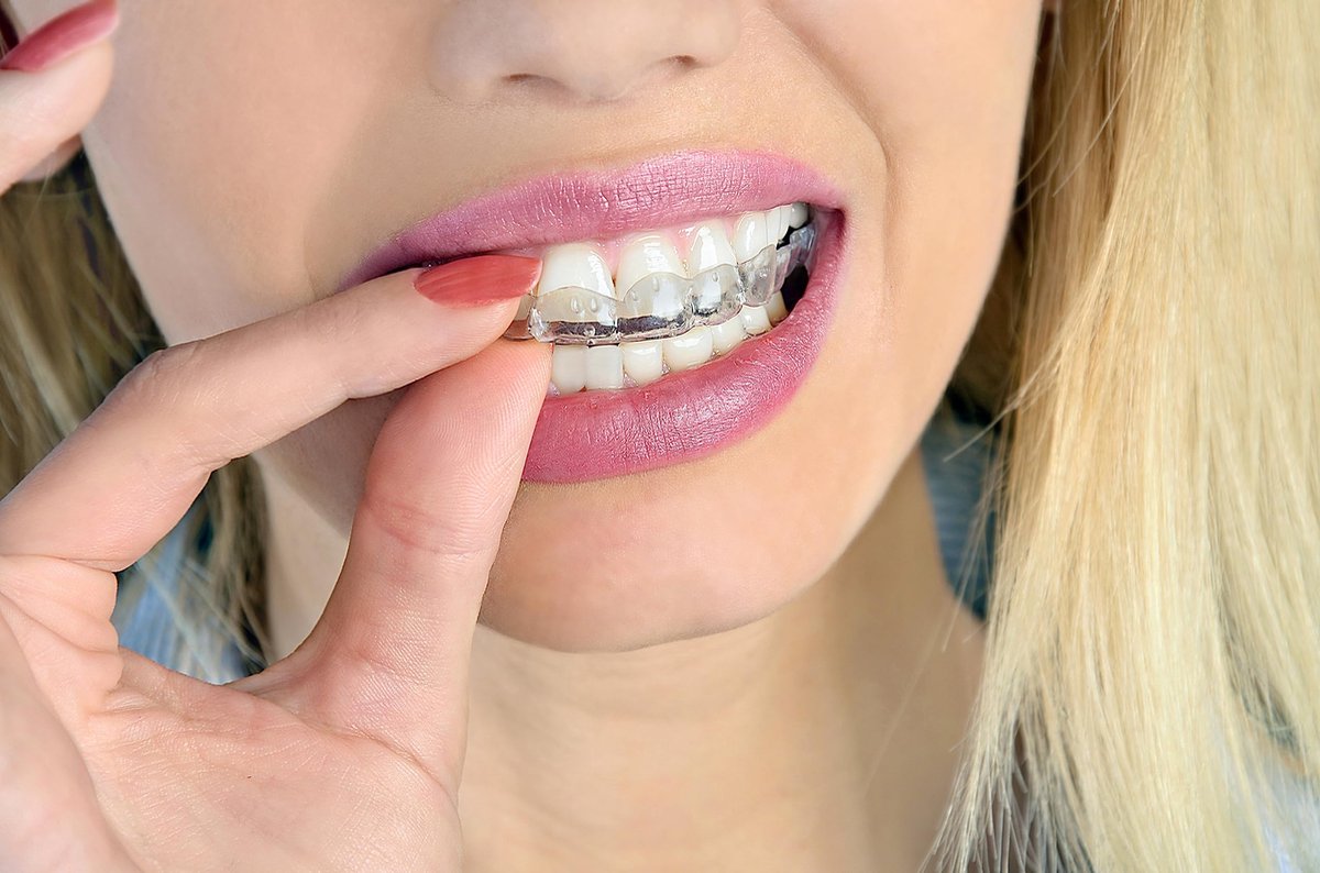 Grehge oth, Bite and Dentures – Breathable Case with Vent Holes – Portable, Durable and Easy to Clean – 75 x 60 x 35 - ShopVlot