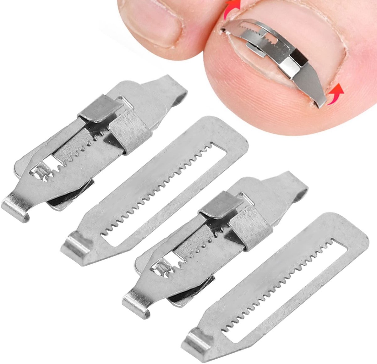 Solidchoice - RVS Correctie Tool voor Ingegroeide Teennagels, 2 Stuks