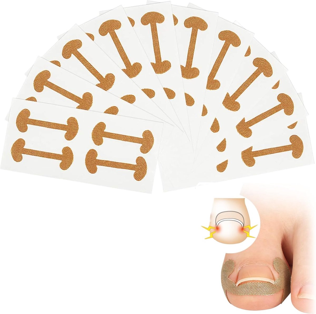 40 stuks teennagelcorrectiepleisters, ingroeiende teennagels nagelklem voetennagels, nagelcorrectieklem, teennagelpleister, teennagelpleisters voor behandeling van ingroeiende teennagels