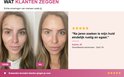 Twee afbeeldingen van dezelfde vrouw: links 'voor' met rode, onrustige huid, rechts 'na' met een rustige, egale huid.