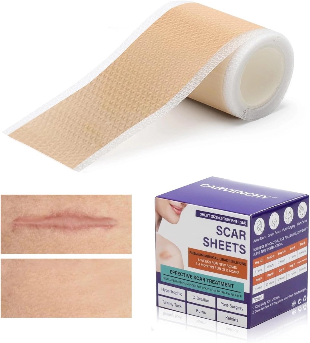 SnelShoppen - Zelfklevende Siliconentape 4 cm x 1,5 m | Afwasbare, Flexibele en Knipbare Tape voor Volwassenen, Perfect voor Bevestigen, Repareren, en