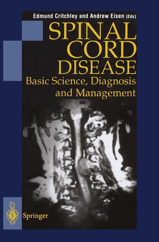 Spinal Cord Disease - cover