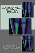 Understanding Deep Vein Thrombosis