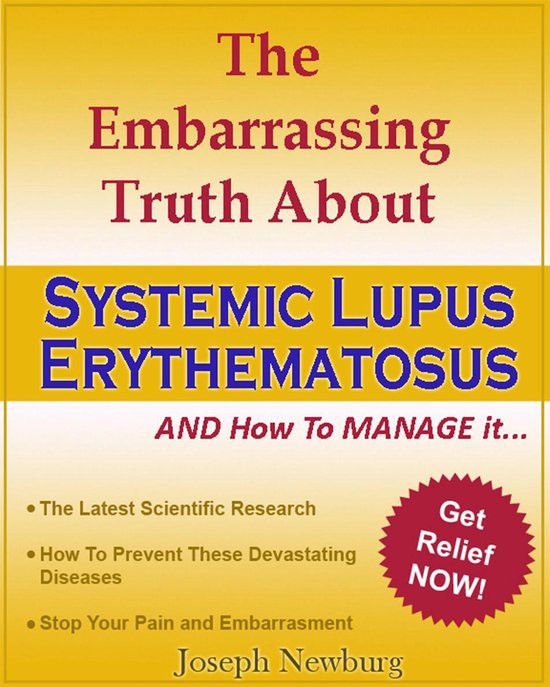 The Embarrassing Truth About Systemic Lupus Erythematosus (S ... - cover