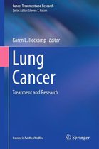 Cancer Treatment and Research 170 - Lung Cancer