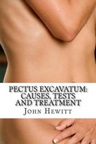 Pectus Excavatum