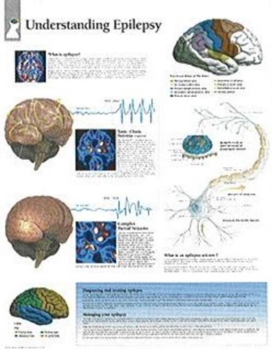 Foto: Understanding epilepsy laminated poster