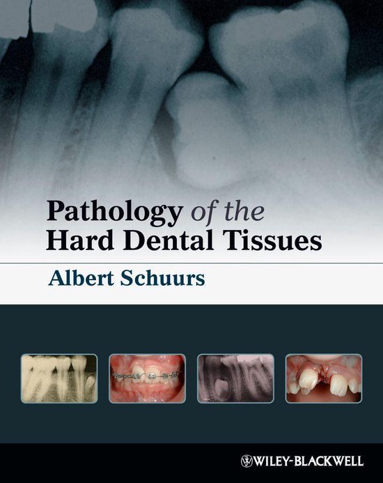 Samenvatting boek Pathology of the Hard Dental Tissues 
