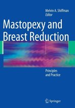 Mastopexy and Breast Reduction