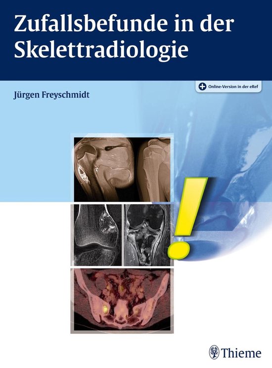 Zufallsbefunde in der Skelettradiologie - cover