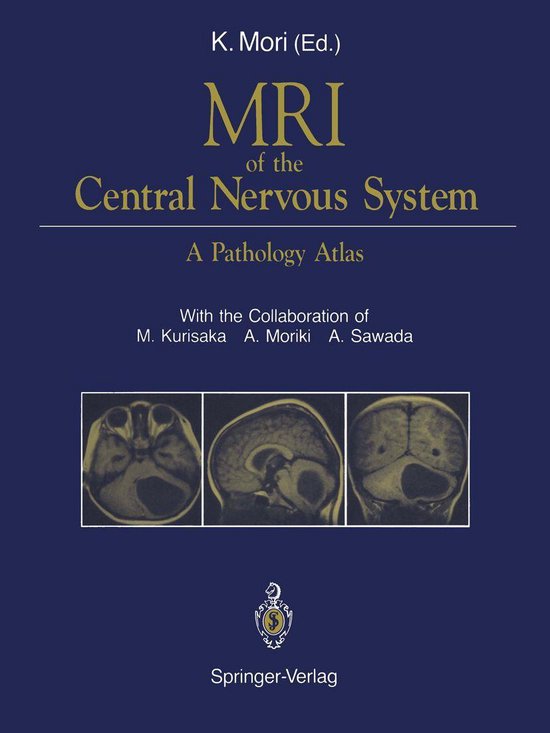 MRI of the Central Nervous System - cover