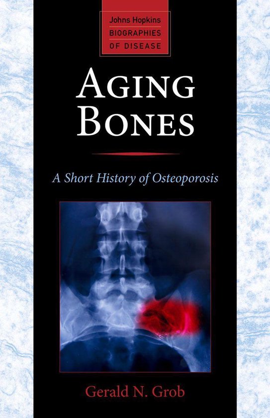 Johns Hopkins Biographies of Disease - Aging Bones - cover