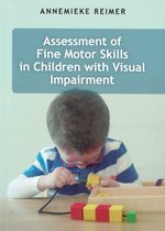 Assessment of Fine Motor Skills in Children with Visual Impairment