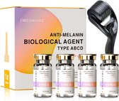 Freezing'Age Anti-Melanine Serum - Huidverzorging Pigmentvlekken - Pigmentvlekken Verwijderen - Hyperpigmentatie Donkere vlekken - 4x 10ml