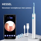 HESSEL - Oorsmeer verwijderaar met camera - Oorreiniger - Oorsmeer reiniger - Oorreiniging - Ear cleaner