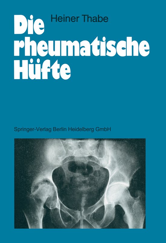 Die Rheumatische Hufte