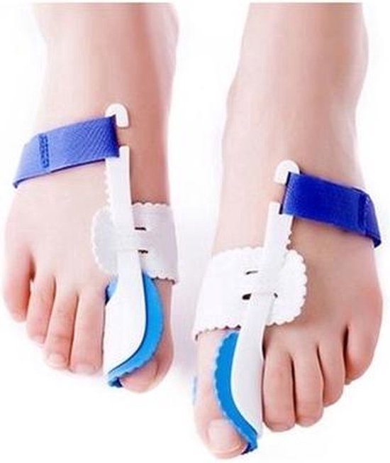 Voeten met twee witte en blauwe grote teen correctoren, bevestigd met blauwe klittenbandbanden.
