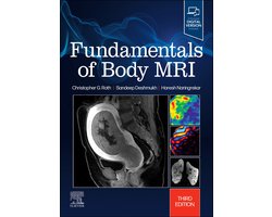 Omslag van Fundamentals of Body MRI