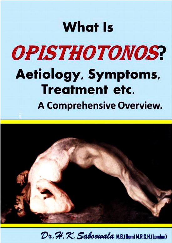 What Is Opisthotonos Aetiology Symptoms Treatment Etc A