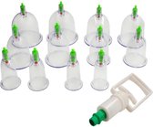 IBBO Shop - Chinese Cupping - Vacuum cups - 12 Delig - Massage - Cupping Set - Cupping Set Massage - Cups - Set 12-Delig