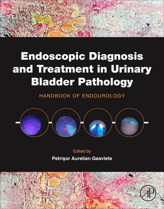 Endoscopic Diagnosis and Treatment in Urinary Bladder Pathology (ebook