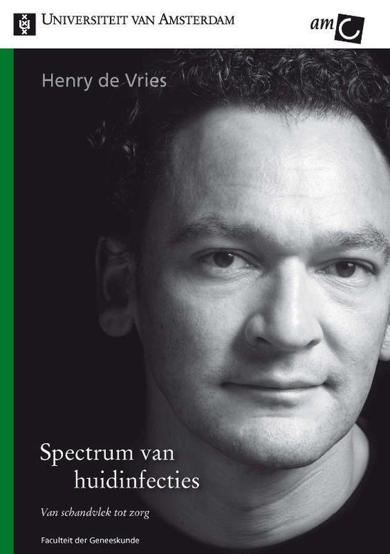 Cover van het boek 'Spectrum van huidinfecties / druk 1' van H. de Vries