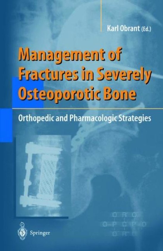 Management of Fractures in Severely Osteoporotic Bone - cover