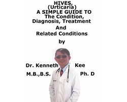 Hives, (Urticaria) A Simple Guide To The Condition, Diagnosis, Treatment And Related Conditions