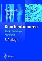 Knochentumoren: Klinik - Radiologie - Pathologie