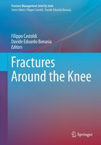 Fracture Management Joint by Joint - Fractures Around the Knee