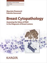 Monographs in Clinical Cytology - Breast Cytopathology