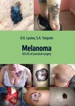 Melanoma. Atlas of Practical Surgery