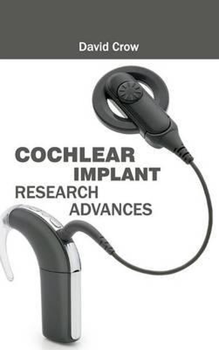 Bol Com Cochlear Implant Research Advances Boeken