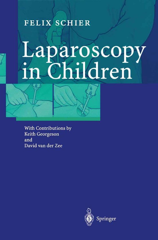 Medicine (R0) - Laparoscopy in Children - cover