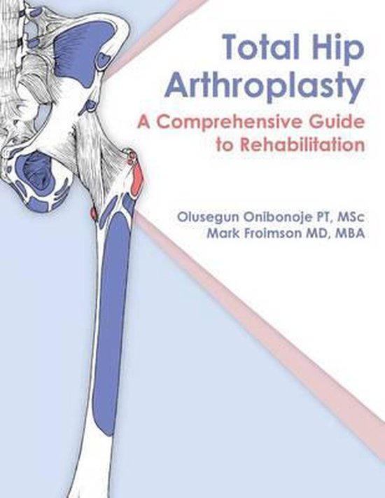 Total Hip Arthroplasty - cover