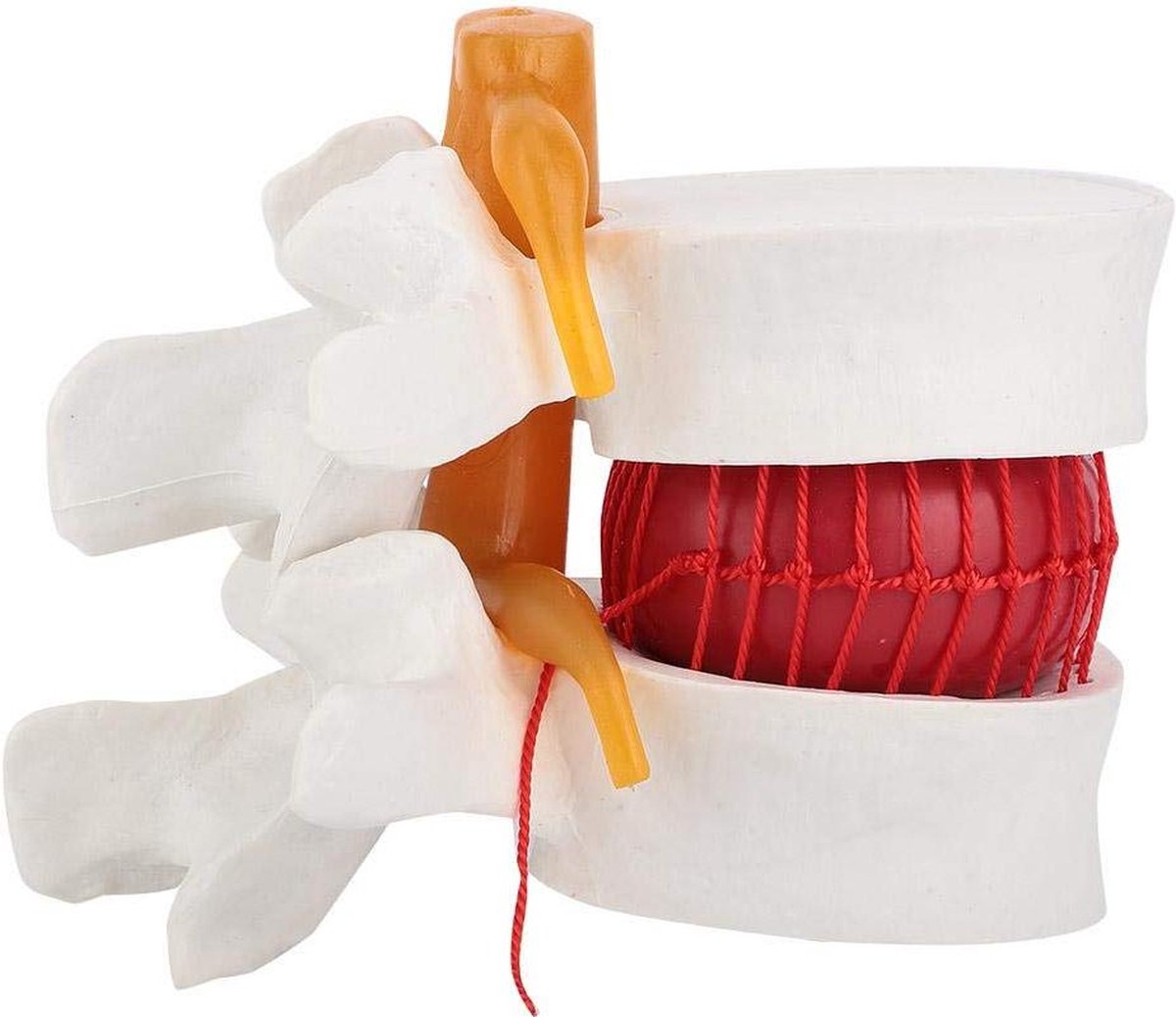 Image of 15 Menselijke lumbale hernia model - wervelkolom anatomische studie - pedagogisch hulpmiddel .