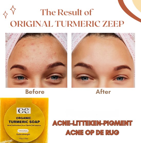 Savon Au Curcuma Pour Le Visage Et Le Corps - Nettoyage En Profondeur - 10g - Format Crème - Neuf