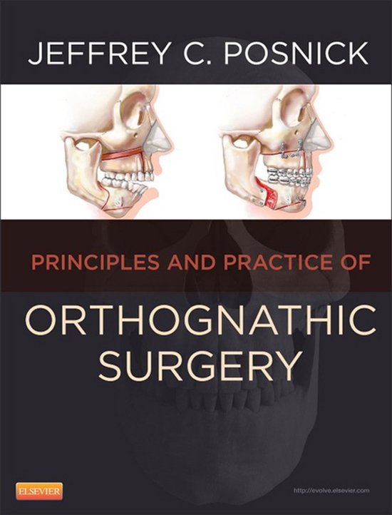 Orthognathic Surgery - cover