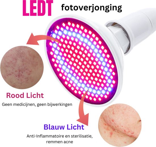 Itsallggoods Infraroodtherapie Infrarood Licht Lichttherapie Huidtherapie bol