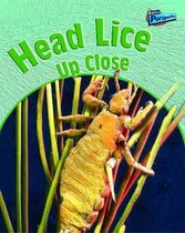 Head Lice Up Close
