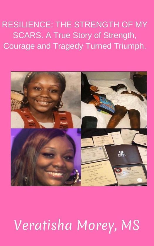 Resilience The Strength of My Scars, a True Story of Strength, Courage