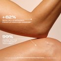 Gedetailleerde close-up van een elleboog en knie. Tekst: 82% huidcellen hersteld van UV-schade. 99% is het eens over de lichte textuur.