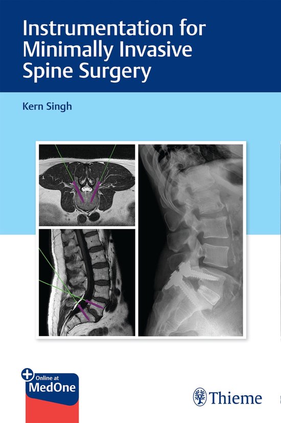 Instrumentation for Minimally Invasive Spine Surgery - cover