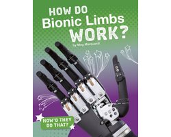 How'd They Do That? - How Do Bionic Limbs Work?