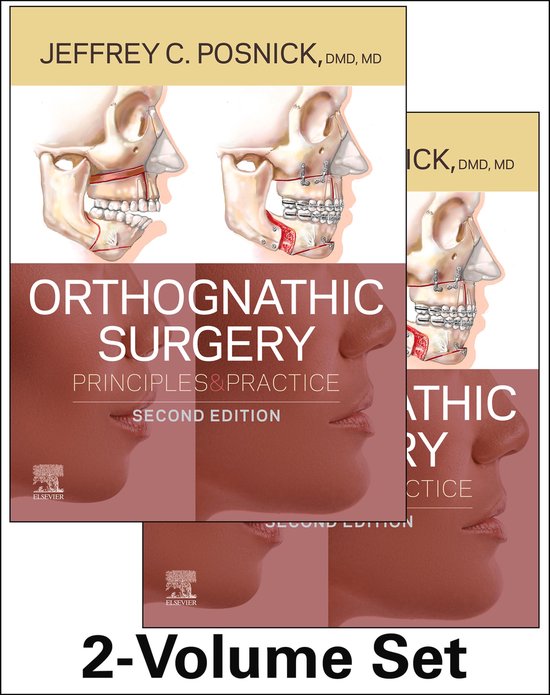 Orthognathic Surgery E-Book - cover