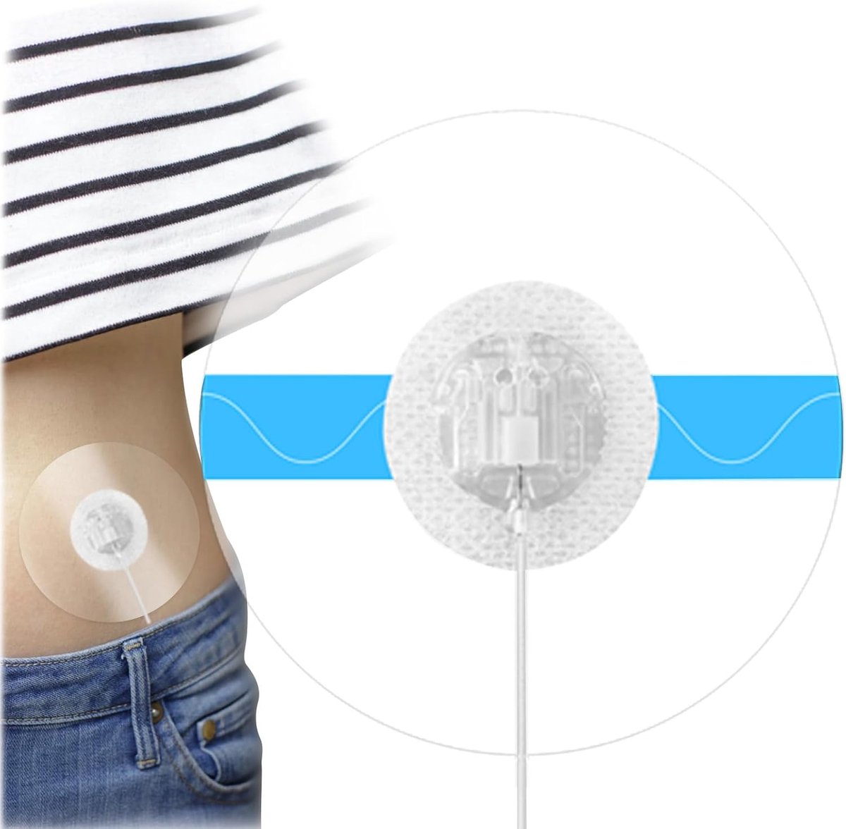 Pack of 20 Insulin Pump Patches, Waterproof and Non-Irritating Skin Insulin Pump, Compatible with Most Insulin - ShopVlot
