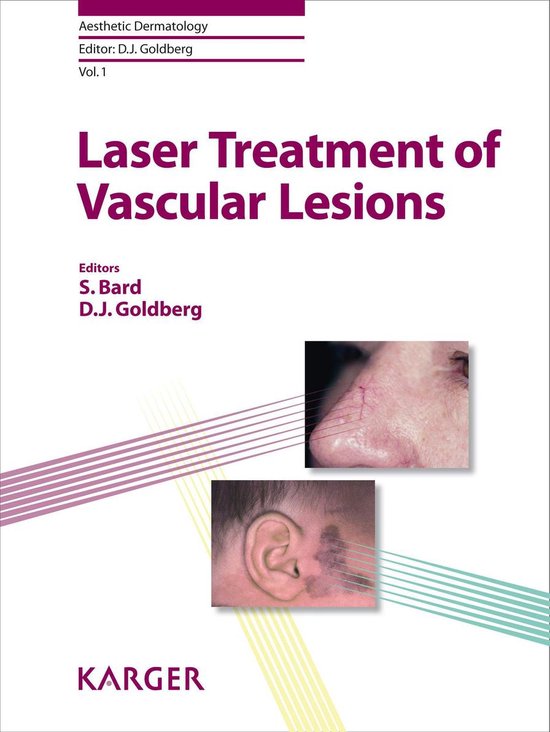 Laser Treatment of Vascular Lesions - cover