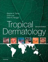 Tropical Dermatology E-Book