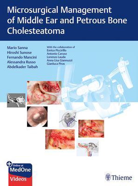 Microsurgical Management of Middle Ear and Petrous Bone Chol ... - cover