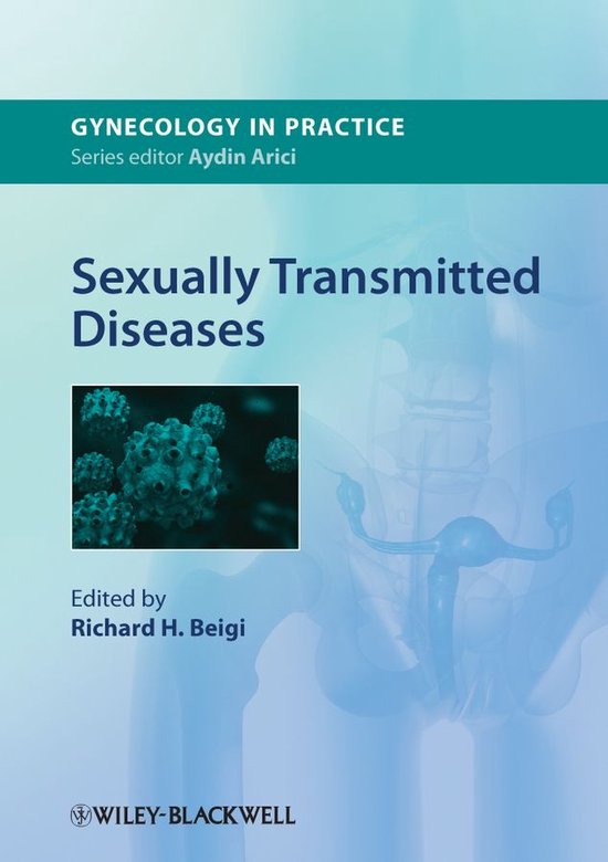 Sexually Transmitted Diseases Ebook R Beigi 9781118314951 Boeken